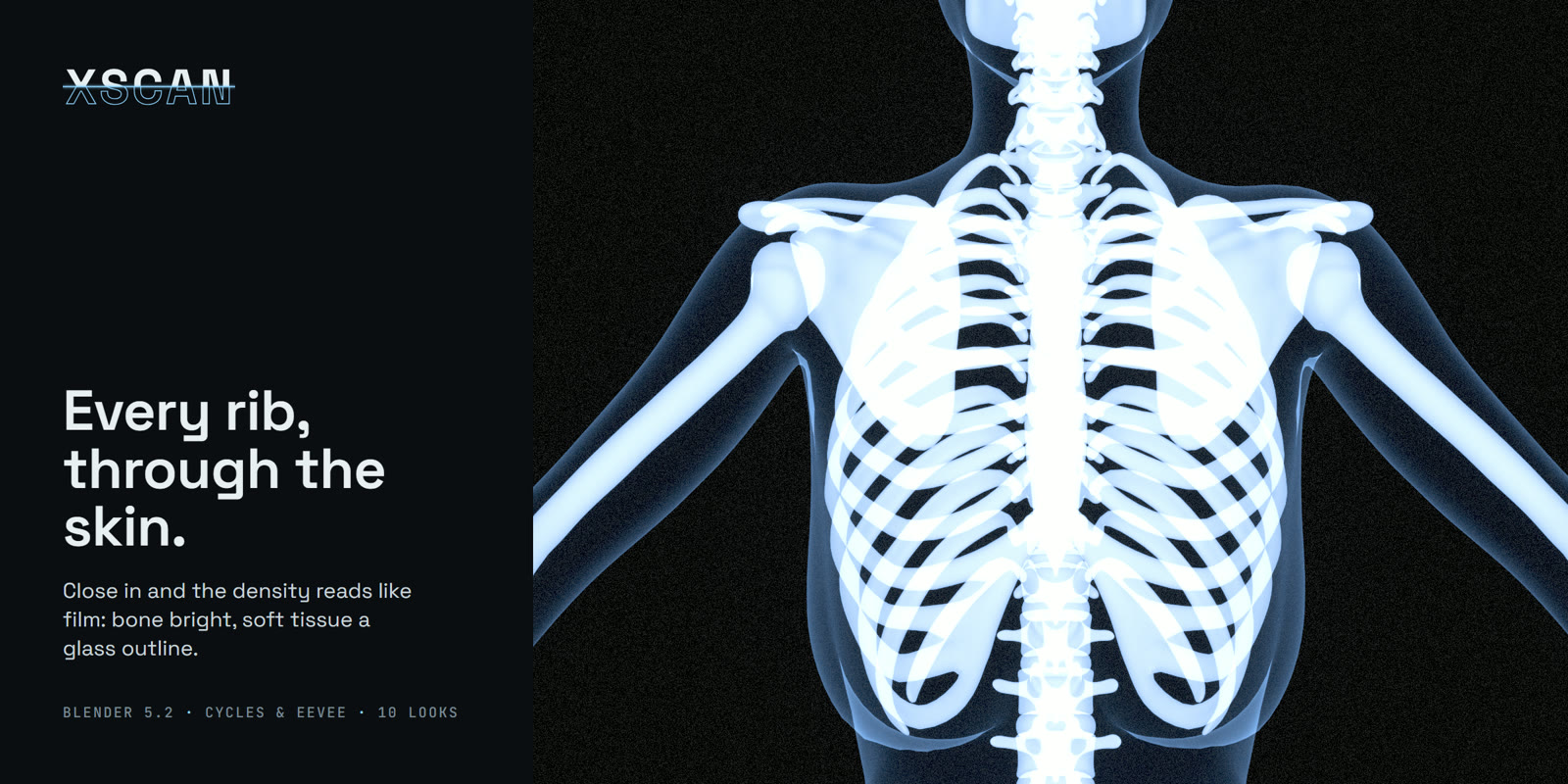 Close X-ray of a ribcage